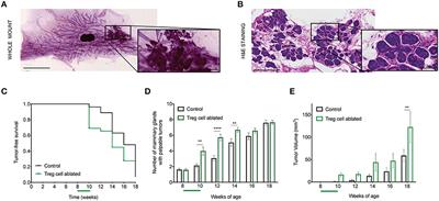 Regulatory T Cells Control the Switch From in situ to Invasive Breast Cancer